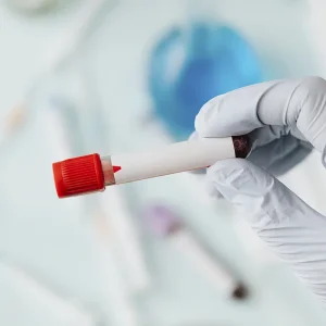 sampel darah pasien untuk tes darah di laboratorium BSI Bali