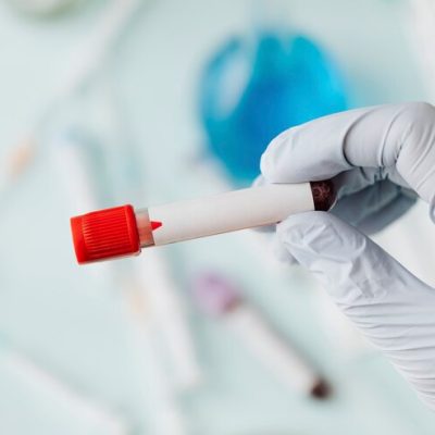 hand-doctor-holding-blood-test-tube-covid-19-outbreak_53876-101441.jpg